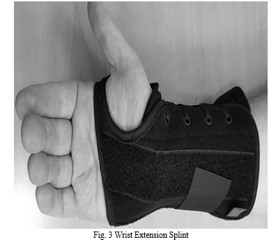 5 Reasons to Wear Wrist Splints - Fitzmaurice Hand Institute
