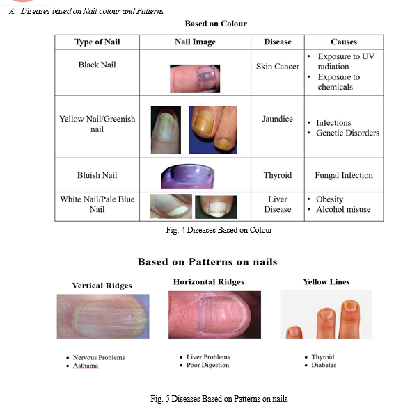 CNN Based Disease Identification using Human Nail Images