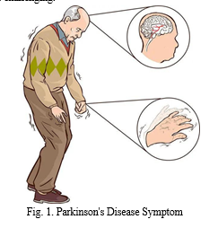 Parkinson Disease Detection from Spiral and Wave Drawings using Machine ...