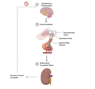 Diabetes Insipidus: Diagnosis, Pathogenesis, and Management